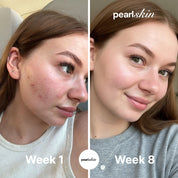 Hyaluronic Acid Serum