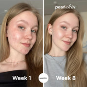 Hyaluronic Acid Serum