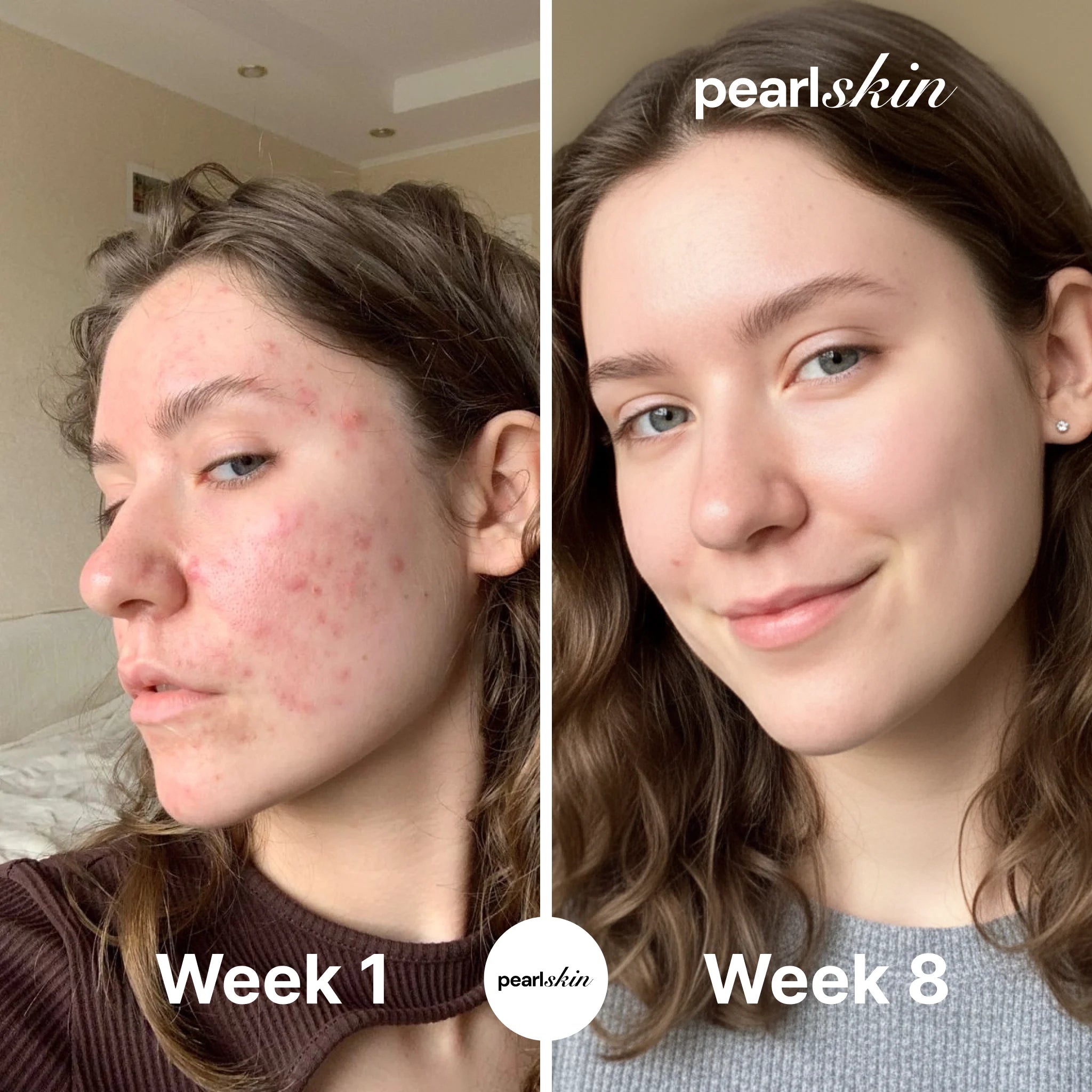 Hyaluronic Acid Serum